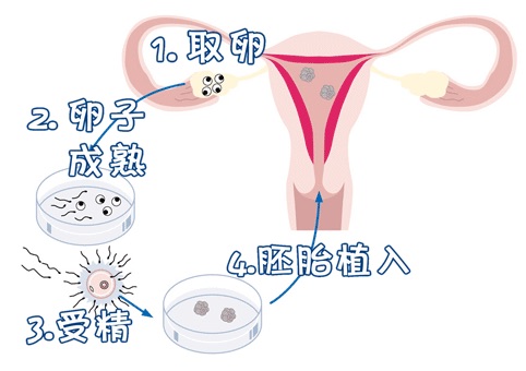 靠谱拉拉借卵咨询